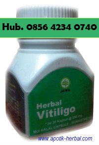 27 Obat Herbal Penyakit Vitiligo Background  Penyembuhan Vitiligo
